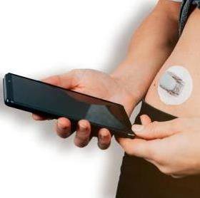 Vrouw met suikerziekte draagt Dexcom CGM glucose sensor en controleert glucosewaarde op haar telefoon