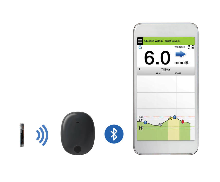 Eversense CGM sensor van Roche