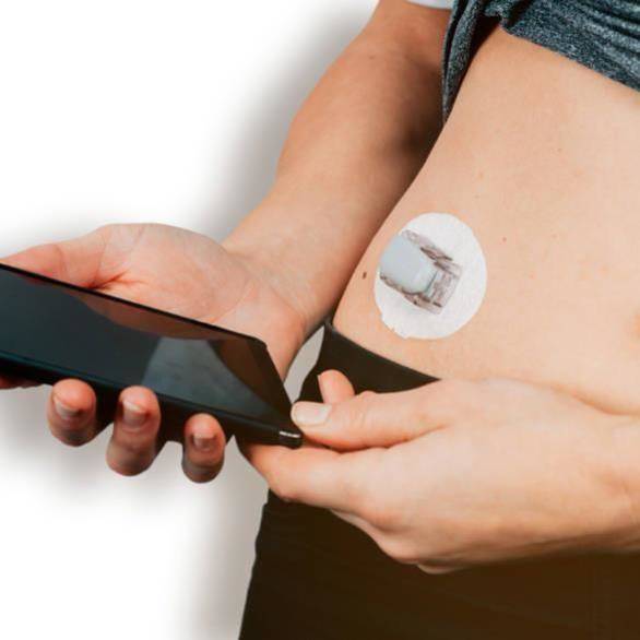 sensor voor continue glucosemonitoring sensor voor continue glucosemonitoring