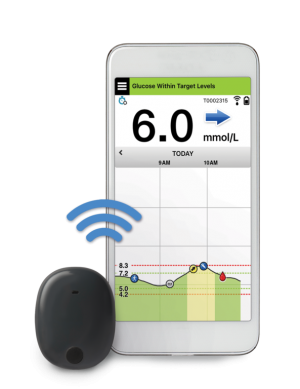 Roche Eversense sensor voor Continue Glucose Monitoring CGM