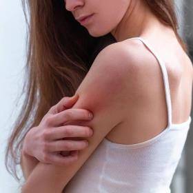 Vrouw krabt aan bovenarm