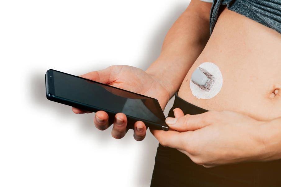 Vrouw met suikerziekte draagt Dexcom CGM glucose sensor en controleert glucosewaarde op haar telefoon