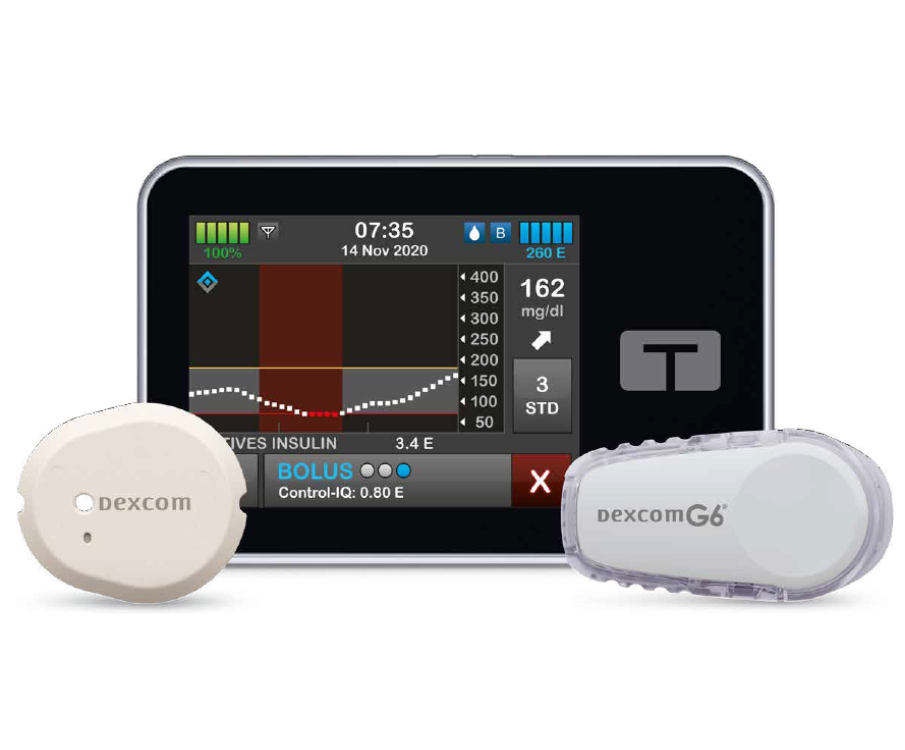 zwarte pomp met het woord bolus en sensoren van dexcom ernaast