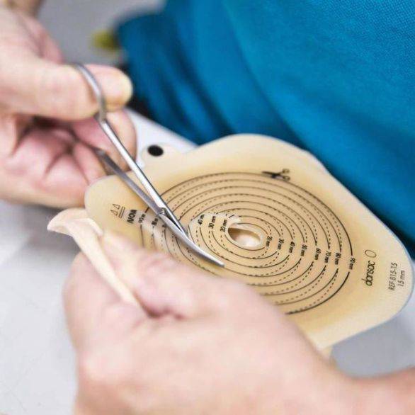 Zorgprofessional knipt een stomaplak