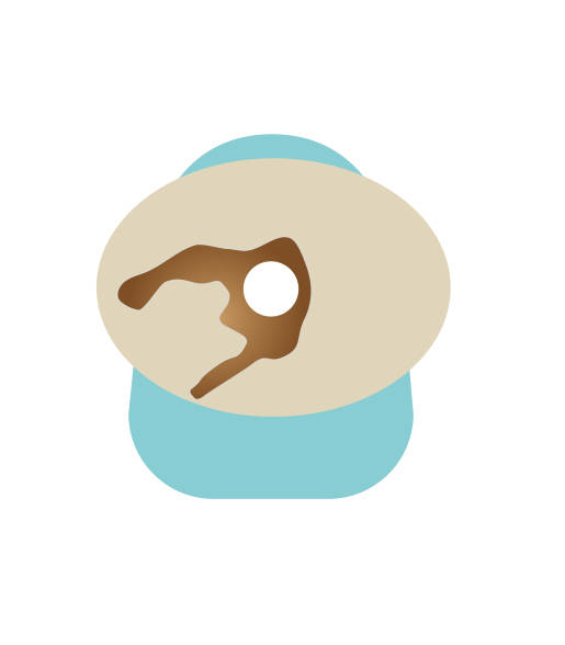 Uitlopers onder de huidplak