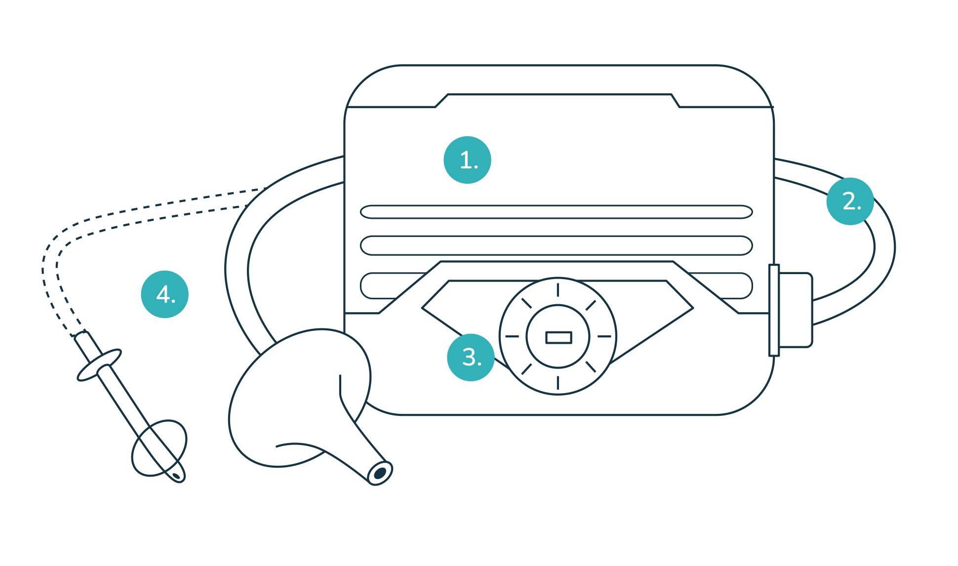 Kenmerken van een elektrische pomp voor stoma irrigeren